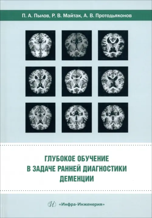 

Глубокое обучение в задаче ранней диагностики деменции, Зелёный