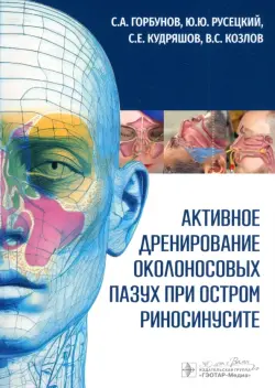 Активное дренирование околоносовых пазух при остром риносинусите